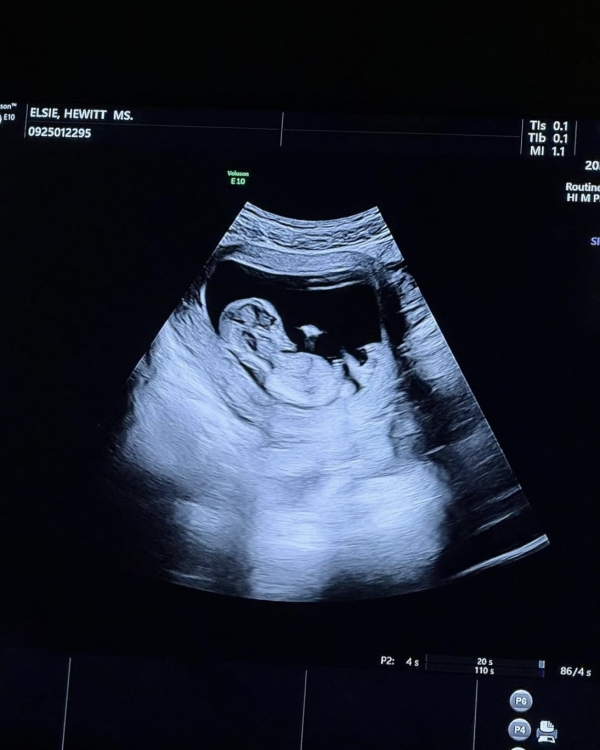 Пит Дэвидсон впервые стал отцом