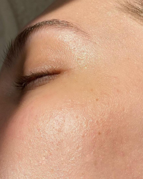 Как подготовить кожу к свадьбе