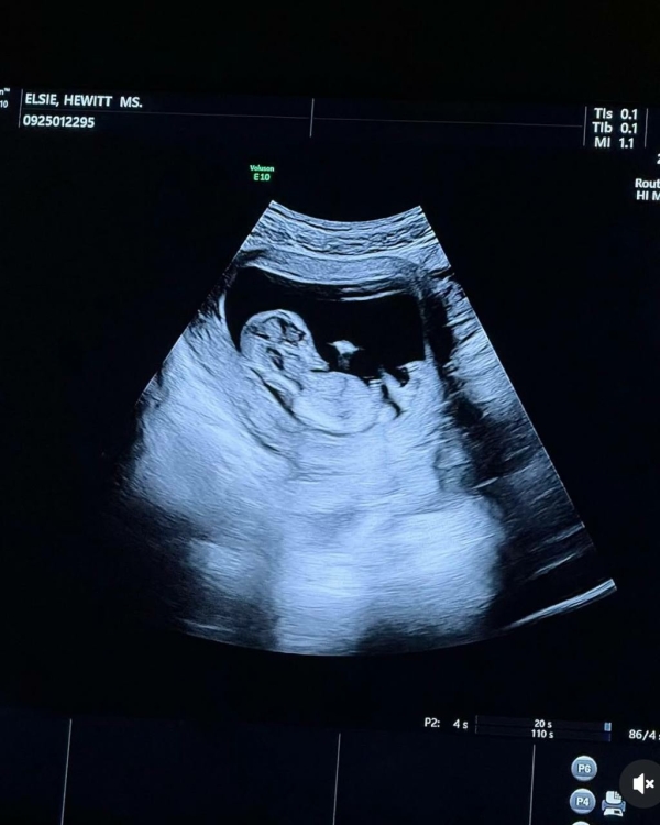 «Ну вот, теперь все знают, что у